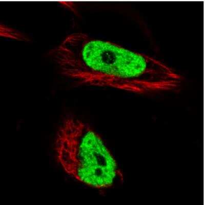 Immunocytochemistry/ Immunofluorescence: hnRNP C1 + C2 Antibody (CL2593) [NBP2-36776]