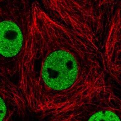 Immunocytochemistry/ Immunofluorescence: hnRNP C1 + C2 Antibody (CL2593) [NBP2-36776]
