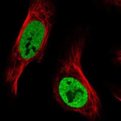 Immunocytochemistry/ Immunofluorescence: hnRNP C1 + C2 Antibody (CL2593) [NBP2-36776]