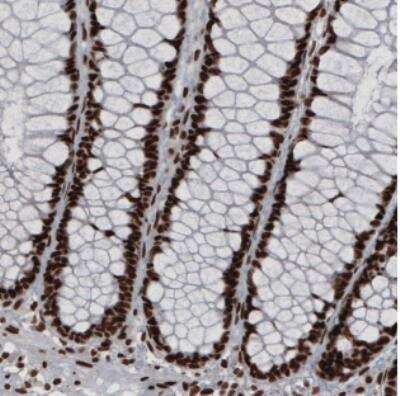 Immunohistochemistry: hnRNP C1 + C2 Antibody (CL2593) [NBP2-36776]