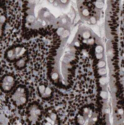 Immunohistochemistry: hnRNP C1 + C2 Antibody (CL2593) [NBP2-36776]