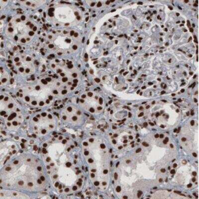 Immunohistochemistry: hnRNP C1 + C2 Antibody (CL2593) [NBP2-36776]