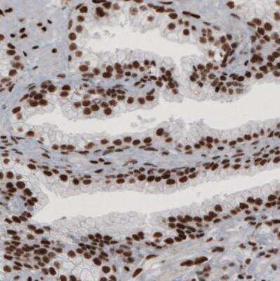 Immunohistochemistry: hnRNP C1 + C2 Antibody (CL2593) [NBP2-36776]