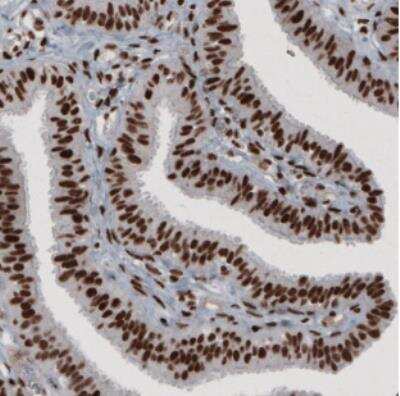 Immunohistochemistry: hnRNP C1 + C2 Antibody (CL2593) [NBP2-36776]