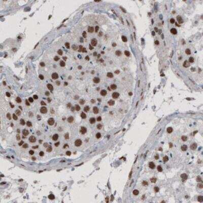 Immunohistochemistry: hnRNP C1 + C2 Antibody (CL2593) [NBP2-36776]