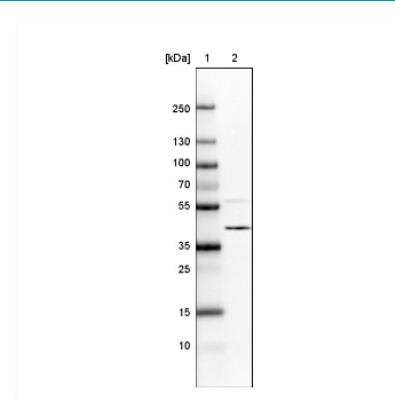 Western Blot: hnRNP C1 + C2 Antibody (CL2593) [NBP2-36776]