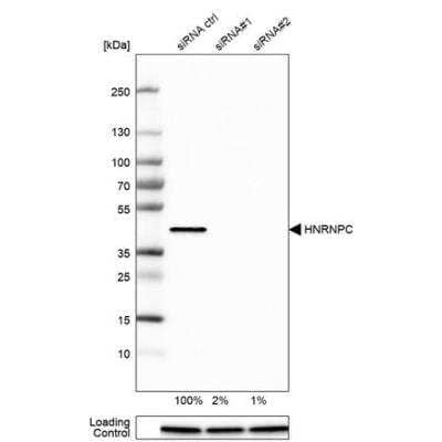 Western Blot: hnRNP C1 + C2 Antibody (CL2593) [NBP2-36776]