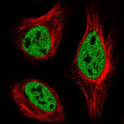 Immunocytochemistry/ Immunofluorescence: hnRNP C1 + C2 Antibody (CL2596) [NBP2-36777]