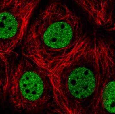 Immunocytochemistry/ Immunofluorescence: hnRNP C1 + C2 Antibody (CL2596) [NBP2-36777]