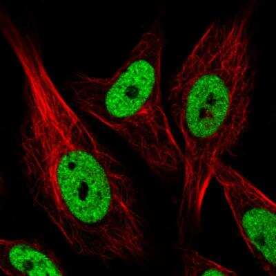 Immunocytochemistry/ Immunofluorescence: hnRNP C1 + C2 Antibody (CL2596) [NBP2-36777]