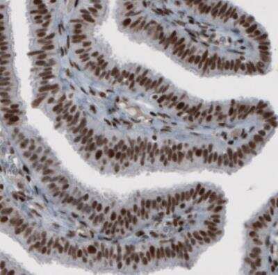 Immunohistochemistry: hnRNP C1 + C2 Antibody (CL2596) [NBP2-36777]