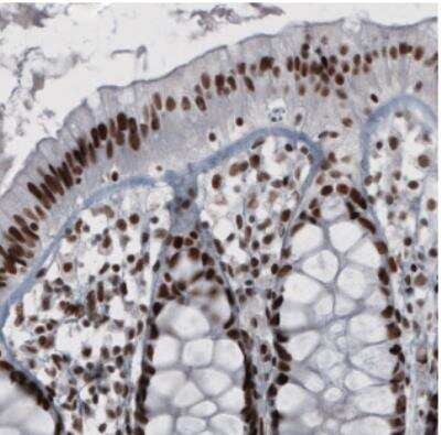 Immunohistochemistry: hnRNP C1 + C2 Antibody (CL2596) [NBP2-36777]