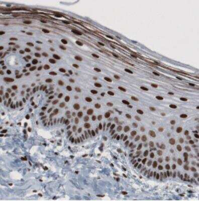 Immunohistochemistry: hnRNP C1 + C2 Antibody (CL2596) [NBP2-36777]