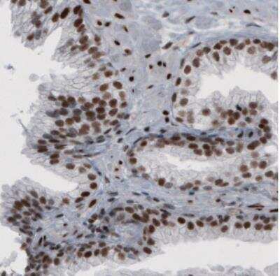 Immunohistochemistry: hnRNP C1 + C2 Antibody (CL2596) [NBP2-36777]