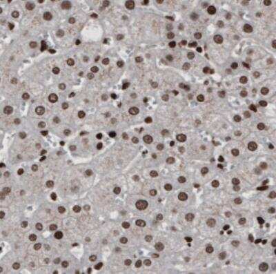 Immunohistochemistry: hnRNP C1 + C2 Antibody (CL2596) [NBP2-36777]