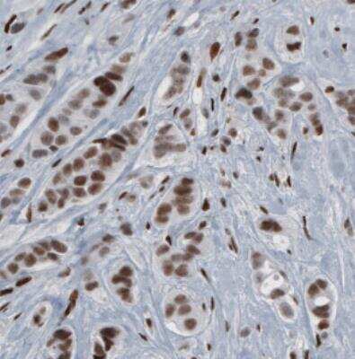 Immunohistochemistry: hnRNP C1 + C2 Antibody (CL2596) [NBP2-36777]