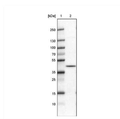 Western Blot: hnRNP C1 + C2 Antibody (CL2596) [NBP2-36777]