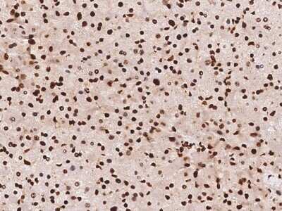 Immunohistochemistry-Paraffin: hnRNP C1 + C2 Antibody [NBP2-98634]