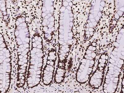 Immunohistochemistry-Paraffin: hnRNP C1 + C2 Antibody [NBP2-98634]