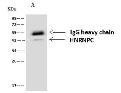 Immunoprecipitation: hnRNP C1 + C2 Antibody [NBP2-98634]