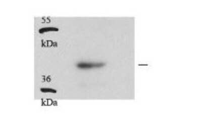 Western Blot: hnRNP C1 + C2 Antibody [NBP1-57153]