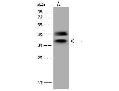 Western Blot: hnRNP C1 + C2 Antibody [NBP2-98634]