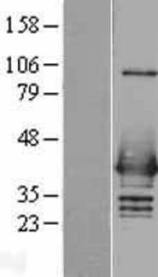 Western Blot: hnRNP C1 + C2 Overexpression Lysate [NBL1-11638]