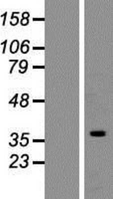 Western Blot: hnRNP C1 + C2 Overexpression Lysate [NBP2-06139]