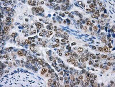 Immunohistochemistry-Paraffin: hnRNP F Antibody (OTI5F5) [NBP2-02221]