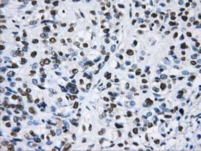 Immunohistochemistry-Paraffin: hnRNP F Antibody (OTI5F5) [NBP2-02221]