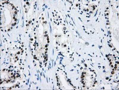 Immunohistochemistry-Paraffin: hnRNP F Antibody (OTI5F5) [NBP2-02221]