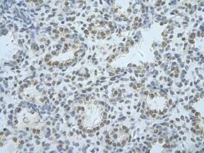 Immunohistochemistry: hnRNP F Antibody [NBP1-57273]