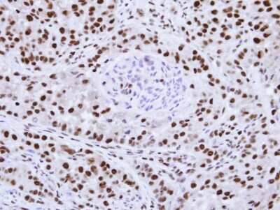 Immunohistochemistry-Paraffin: hnRNP F Antibody [NBP1-33607]
