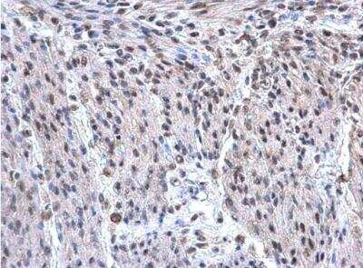 Immunohistochemistry-Paraffin: hnRNP F Antibody [NBP1-33607]