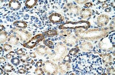 Immunohistochemistry-Paraffin: hnRNP F Antibody [NBP1-57273]