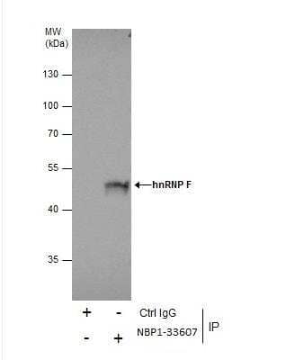 Immunoprecipitation: hnRNP F Antibody [NBP1-33607]