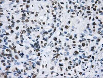 Immunohistochemistry: hnRNP F Antibody (OTI5F5) - Azide and BSA Free [NBP2-70907]