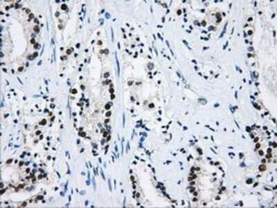 Immunohistochemistry: hnRNP F Antibody (OTI5F5) - Azide and BSA Free [NBP2-70907]
