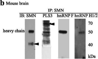 Western Blot: hnRNP F Antibody [NBP1-57273]