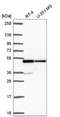 Western Blot: hnRNP F Antibody [NBP2-57442]