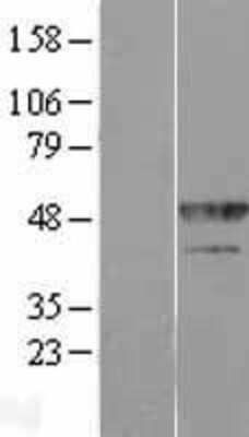 Western Blot: hnRNP F Overexpression Lysate [NBP2-10928]