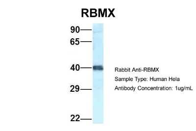 Western Blot: hnRNP G Antibody [NBP1-79904]