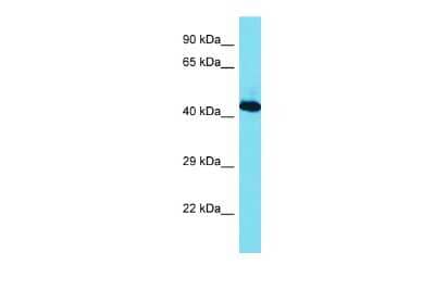 Western Blot: hnRNP G Antibody [NBP2-85052]