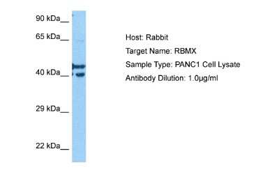 Western Blot: hnRNP G Antibody [NBP2-85053]