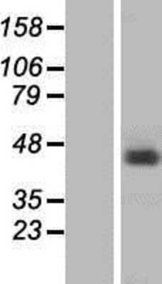 Western Blot: hnRNP G Overexpression Lysate [NBP2-10806]