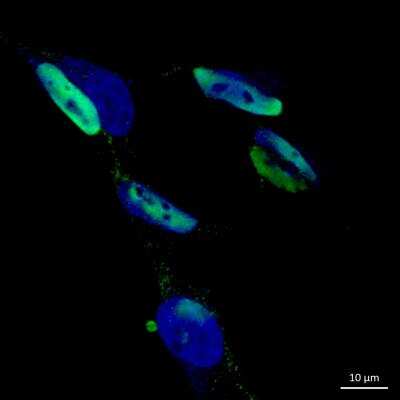 Immunocytochemistry/ Immunofluorescence: hnRNP H Antibody [NB100-385]