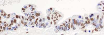 Immunohistochemistry-Paraffin: hnRNP H Antibody [NB100-385]