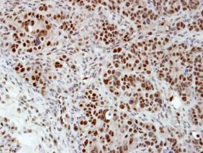 Immunohistochemistry-Paraffin: hnRNP H Antibody [NBP1-31648]