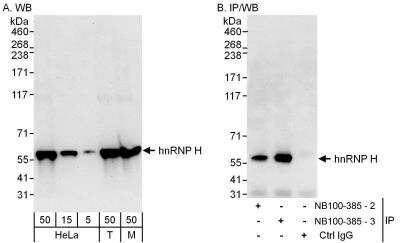 Western Blot: hnRNP H Antibody [NB100-385]