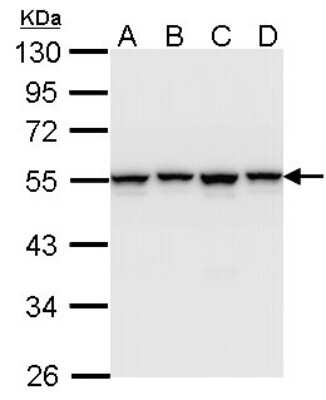 Western Blot: hnRNP H Antibody [NBP1-31648]